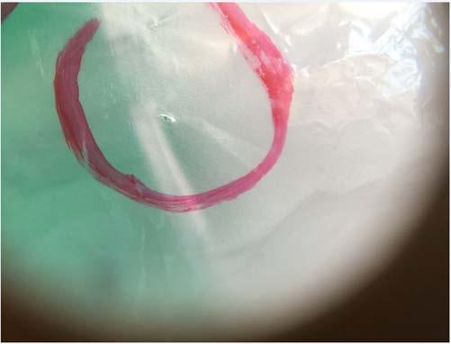 numer markerats med gul ruta. Steg 1: Orsaken till en potentiellt försämrad sterilitet är ett litet hål i transparent film.