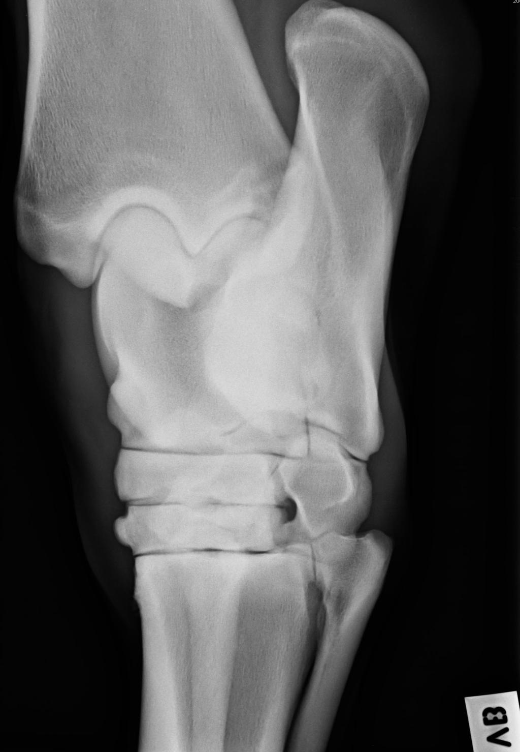 plantaromedial Transversal STIR oblique