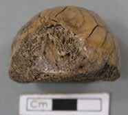 Fnr. 1769 Sländtrissa(?) av ben från nöt, femur proximal. Halvsfärisk form med genomgående hål.