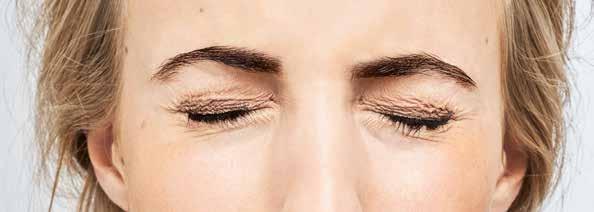 Daglig ögonlocksbehandling i tre steg för personer med MGD 1) VÄRM UPP För att mjuka upp fettet i körtlarna på ögonlocken behövs värme.
