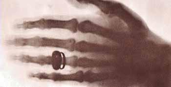 Sjukhusfysikerprogrammet I mer än 100 år har strålning använts inom sjukvården i syfte att diagnostisera och behandla sjukdomar som till exempel cancer.