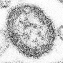 Morbilli, mässling Paramyxovirus (RNA-virus) luftsmitta aerosol, en av de mest