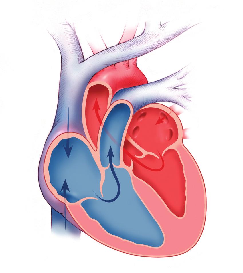 Sinusknutan AV-knutan Figur 1. Hjärtat och dess elektriska banor.