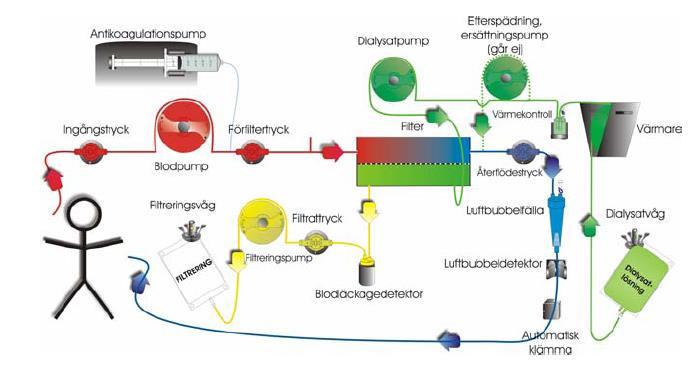 CVVHD (Continuous Veno-Venous HemoDialysis) TILLBEHÖR ERSÄTTNING/DIALYSAT KLÄ MASKINEN PRIMING BEHANDLING UTAN ANTI-KOAGULATION Filter 1,2 m 2, ersättnings- och dialysatlösning, avflödespåsar,