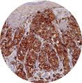 This is achieved by reviewing hematoxylin and eosin (H&E) stained sections of each donor block.