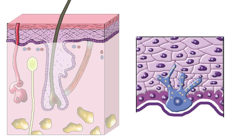 Diseases of melanocytic origin Melanocytes are neural crest-derived cells residing in the basal layer of the epidermis (Figure 4), hair follicle and eye.