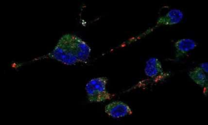 Figure 28. Confocal microscopy on stimulated D1 cells. Nuclei (blue), construct (green), EEA-1 (red), LAMP-1 (white) are shown.