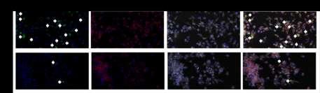 Whereas liposomes targeted fewer cells, the soluble fusion protein was taken up by a larger number of cells (Figure 29).