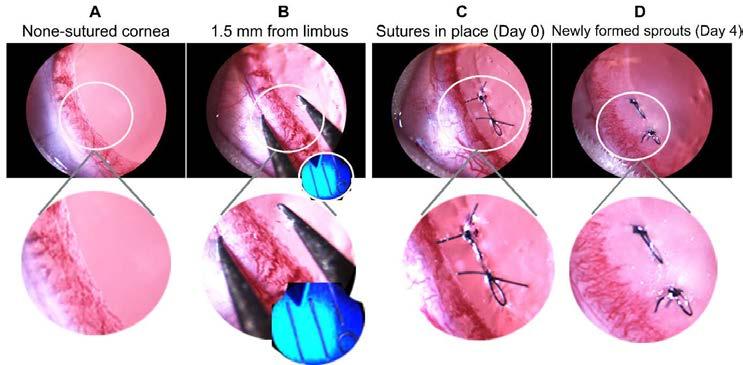suture placement, the newly formed sprouts extend from the limbus to about half of the distance to the sutures (Fig.4). Figure 4.