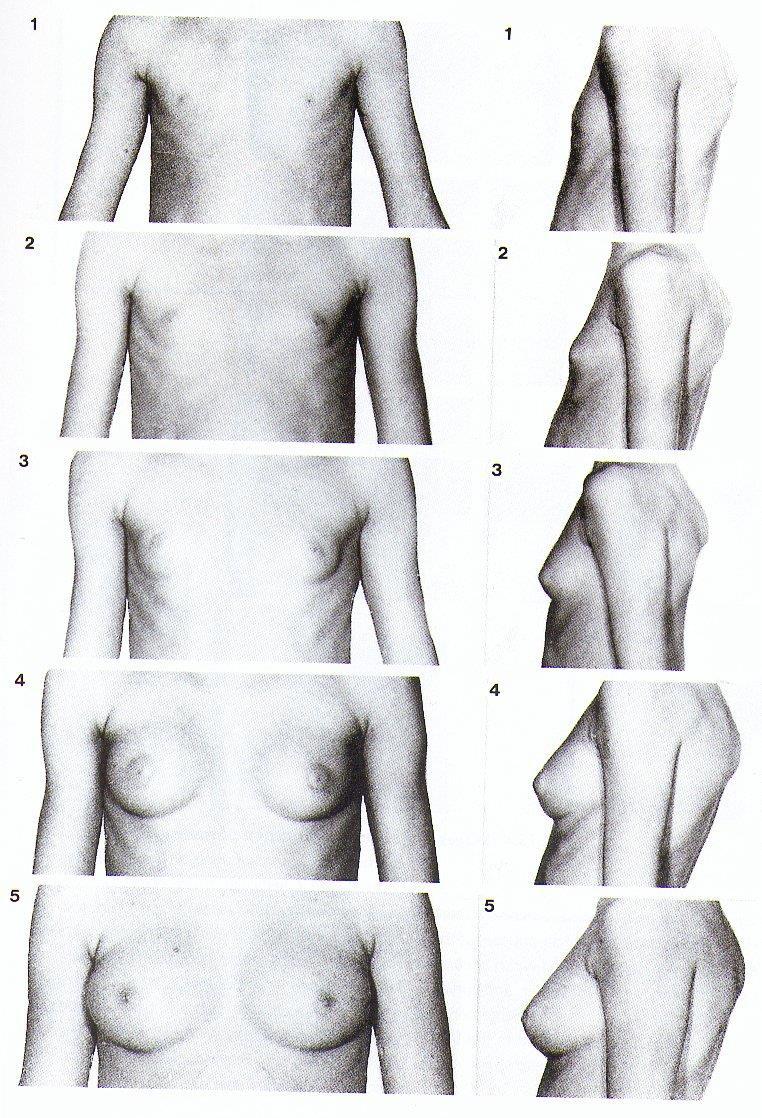 Tanner stadium B1-5 Bröstutvecklingen är