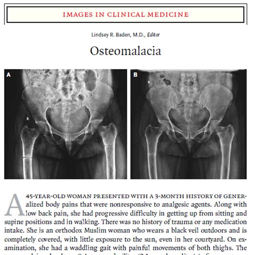 45 årig muslimsk kvinna med täckande klädsel. 3 mån generell kroppssmärta som inte svarat på analgetika. Ländryggssmärta, svårt att resa sig från sittande och att gå.