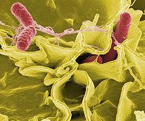 Sjukdomar som sprids via vatten & markerosion Bakterier gynnas av värme & fukt Sporbildande bakterier = stor