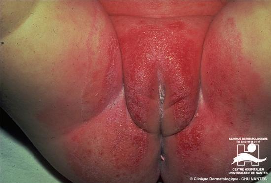 Diagnos?