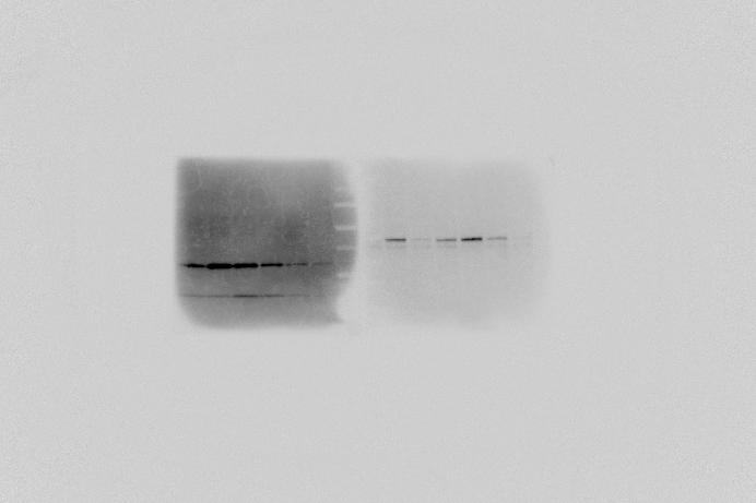 ) grown hydroponilly were used for western blot nlysis. The mirosome frtion ws frtionted by surose-density grdient.