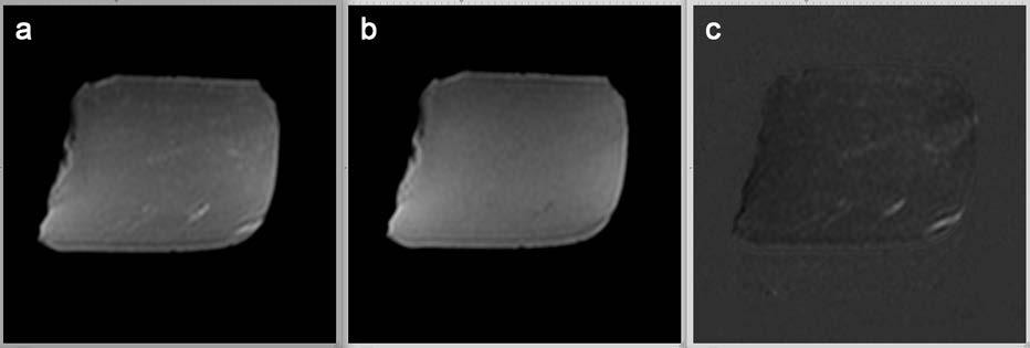60 50 ID 8 ID 3 Fett % DT 40 30 20 10 ID 7 ID 9 ID 2 ID 4 ID 5 0 0 50 100 150 200 250 Fettvolym helkropp (cm3)/ femur (cm) Figur 10. Fettprocent jämfört mot normaliserad kroppsfettvolym.