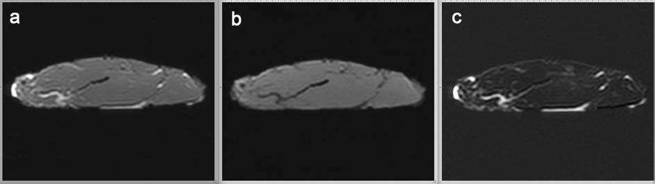 Figur 12. Bilder av magnetresonanstomografiskt undersökt del av musculus longisimus dorsi från individ 8, BCS 7. T1W-TSE (vänster), T1W TSE SPIR (mitten) och subtraktion (höger).
