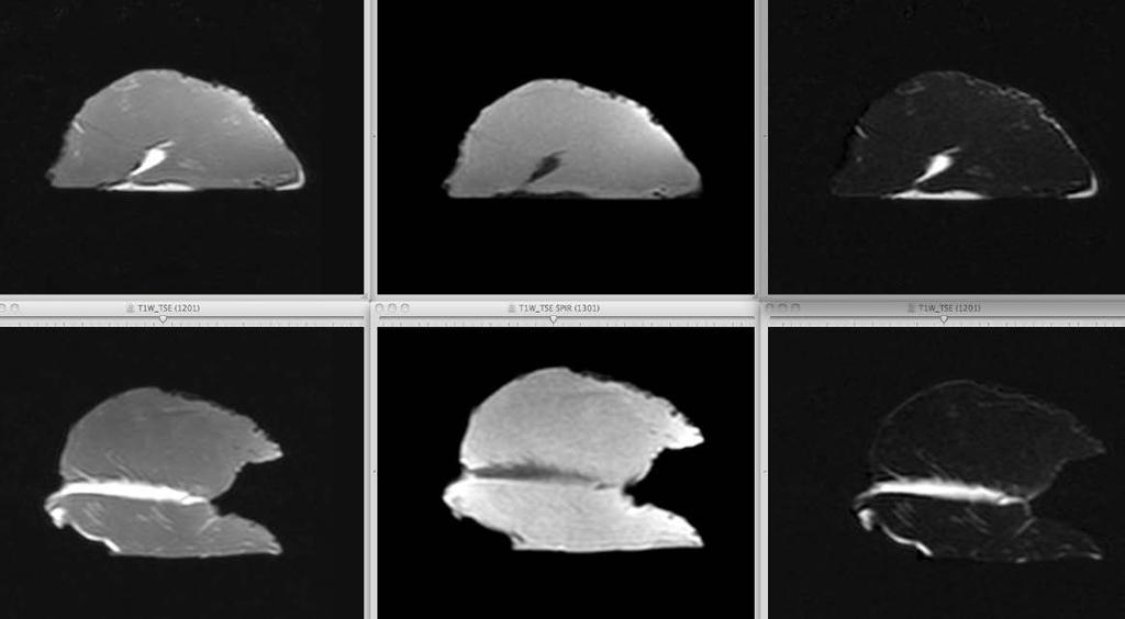 Fyra individer (katt ID 2, 3, 5 och 8) gav en homogen fettsignal med en generell lokalisation. Muskel från en katt (katt ID 4) MRT-undersöktes efter att den formalinfixerats.