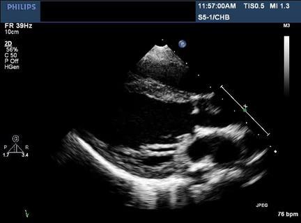 Differential diagnoser: