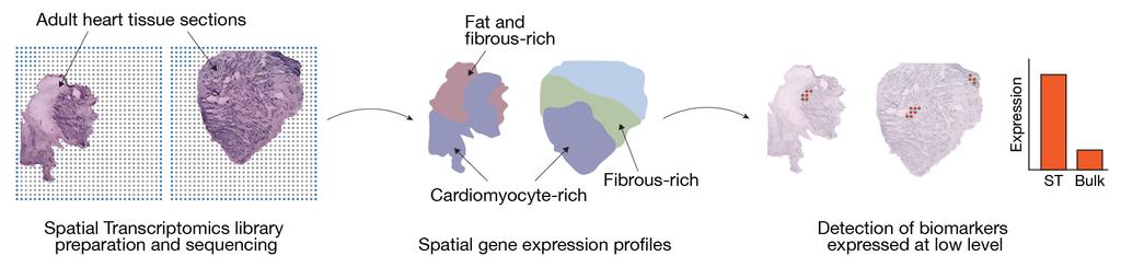 Spatially Resolved Gene Expression Analysis Paper II Detecting lowly expressed biomarkers in heart failure disease progression Studying human adult heart biopsies has previously only been carried out