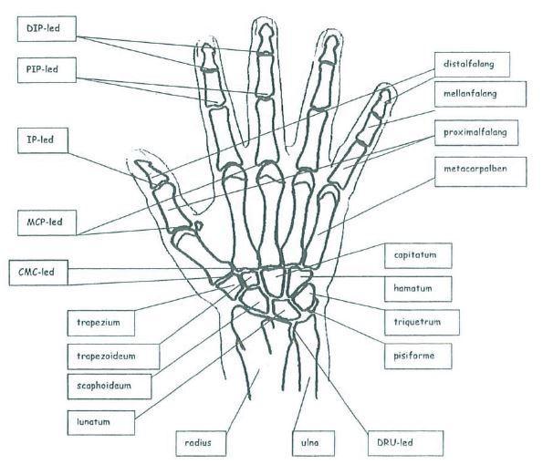 Vårdprogram 3(25) Handskelett DIP-led - distal interfalangeal led PIP-led - proximal interfalangeal led IP-led -