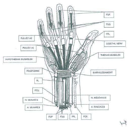 Vårdprogram 6(25) Handens böjsenor FDP- FDS- FPL- FCR- FCU- PL- PULLEY- m.flexor digitorum profundus m.