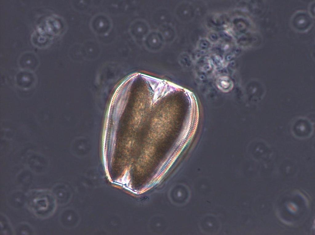 Coscinodiscus granii, överst till höger den