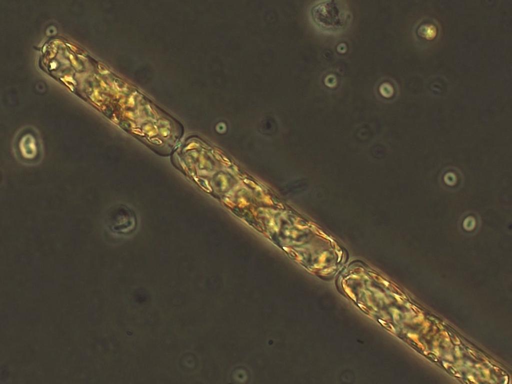 vänster den mixotrofa ciliaten Mesodinium