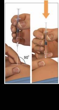 Steg 6: Nyp försiktigt ihop huden på injektionsstället Nyp försiktigt ihop huden på det rengjorda injektionsstället med tummen och