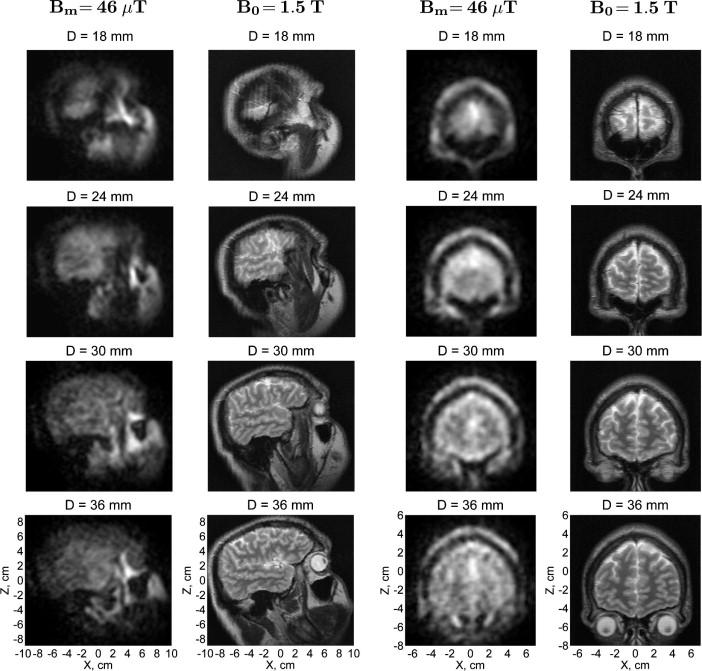 device) Ultra-low field MRI with SQUID