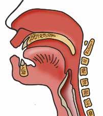 A Fri luftväg med stabilisering av halskotpelaren A i L-ABCDE står för Airway and cervical spine control (fri luftväg med stabilisering av halsryggen).