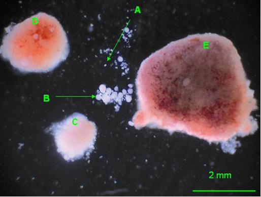 Figure 11) Islets and pancreatic endocrine tissue specimens in a Men1 +/- mouse after collagenase treatment.