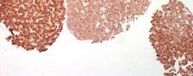It has been suggested that Men1 is up-regulated in Men1 +/- islets to compensate for loss of the wt allele, as no expression difference was found for Men1 +/- and wt islets.