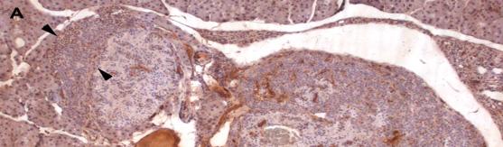 Figure 16) Immunoreactivity of menin, Notch1 NICD, Hes1 and