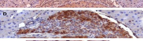 pancreatic endocrine tumour cell line BON1, by applying RNA