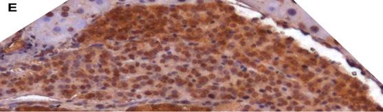 the protein expression of selected target genes in PETs.