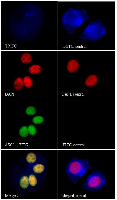 (A) (B) Figure 17) Immunoflourescence of ASCL1 (A) and HES1 (B) expression in BON1 cells. Cells were visualised by TRITC-labelled (blue) phalloidin, DAPI (red).
