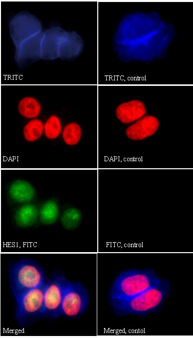 Yellow colour (merged) indicates co-localisation. immunostaining. ASCL1 and HES1 were clearly expressed in BON1 cells, with prominent nuclear association (Figure 17).