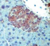 No association of protein expression of examined factors to hormonal profile and clinical behaviour of tumours No association of hormonal profile, WHO classification, TNM staging or Ki-67 index and