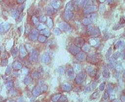 In pancreatic progenitor cells Notch signalling regulates the number of Neurog3 positive cells by repressing Neurog3 expression by preserving high levels of Hes1.
