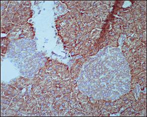 Significant expression differences of Pou3f4, Dlk1 and Rpl10 between Men1 +/- islets and wt islets Sixteen of 23 tumours expressed POU3F4, predominantly located to the cytoplasm.