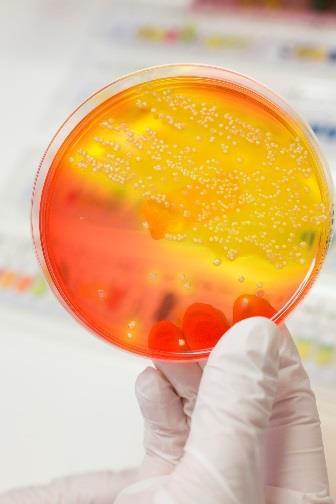 Vancomycin-variabel Enterokock (VVE) E. faecium som inte fenotypiskt uttrycker den vana gen som den bär på.