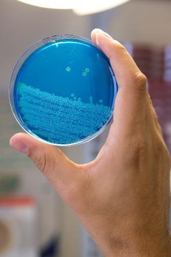 aureus Förekommer mellan 0,16% (Europa) - 18,6% (Asien) i olika