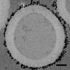 MBs and cells were quantified by counting in five to nine random regions-of-interest (ROIs) per sample.