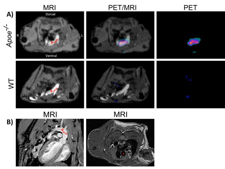 Results and Discussion sections of Apoe -/- mice, but the signal was absent in wild-type mice without macrophage staining (indicated by CD68).