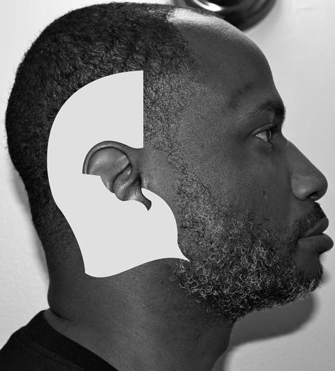 526 Moskovitz & Sabatino Fig. 14. Greater auricular and lesser occipital nerve distribution. (Courtesy of Alisa Gibson, MD, DMD. University of Maryland School of Medicine, Baltimore, MD.