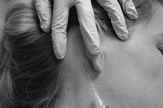 One should redirect posteriorly, along the direction of the helix, then aspirate, and once again inject while pulling back (Fig. 13).
