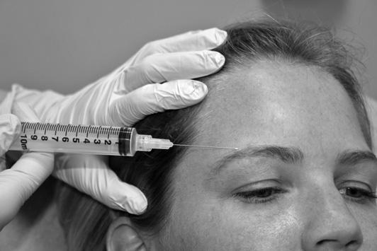 520 Moskovitz & Sabatino Fig. 1. Supraorbital, supratrochlear, and infratrochlear nerve distribution. (Courtesy of Alisa Gibson, MD, DMD. University of Maryland School of Medicine, Baltimore, MD.