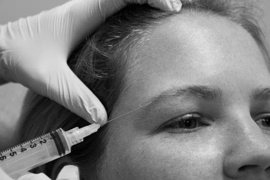8). The intraoral approach entails pulling the upper lip out with the thumb and placing 1 finger on the infraorbital ridge externally.