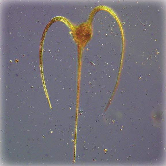 Växtplanktonproverna filtrerades genom µm polycarbonat filter och analyserades i ljusmikroskop. Potentiellt giftiga alger är markerade med *.