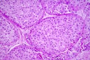 Immunostainings or FISH ER+ PgR